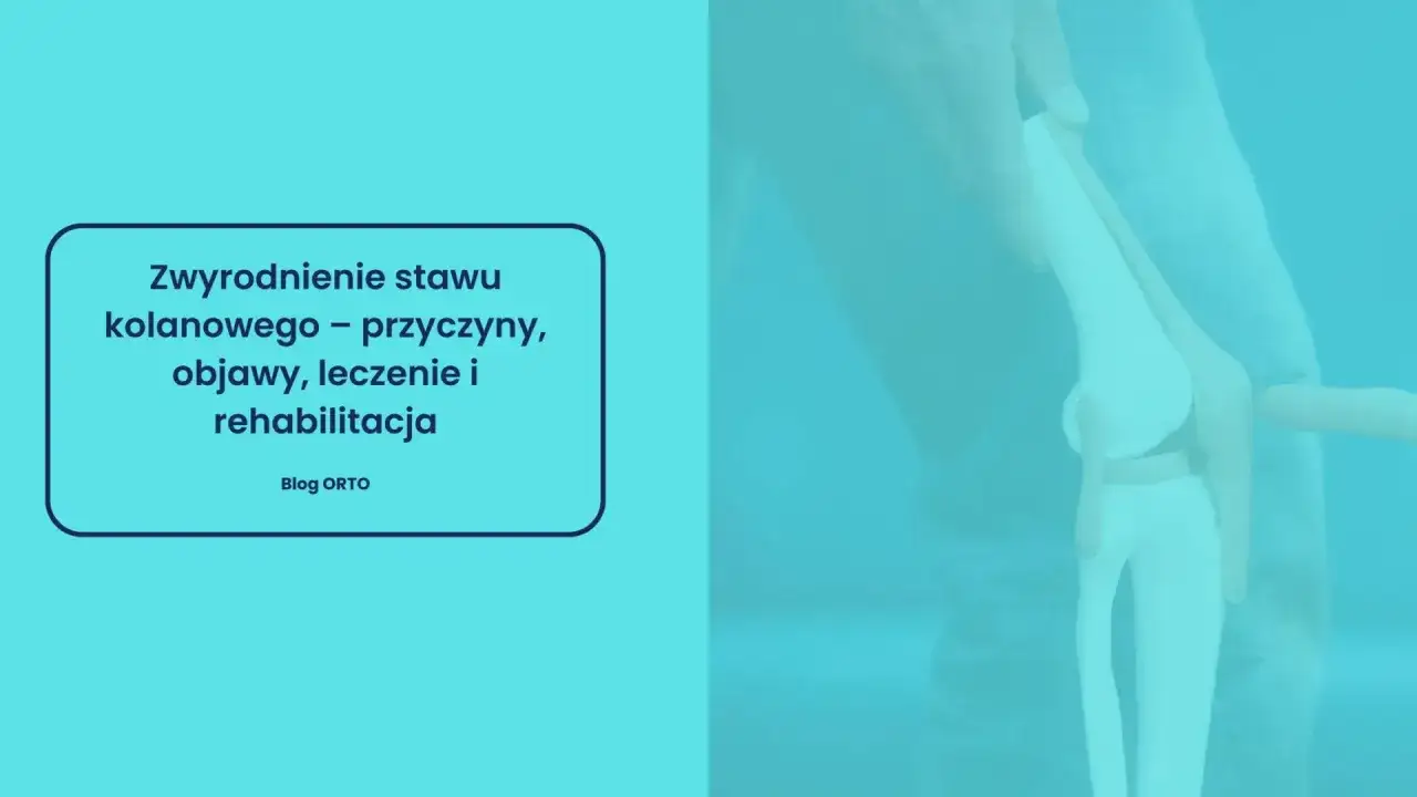 Anatomical model of a knee joint, illustrating the effects of zwyrodnienie stawu kolanowego.