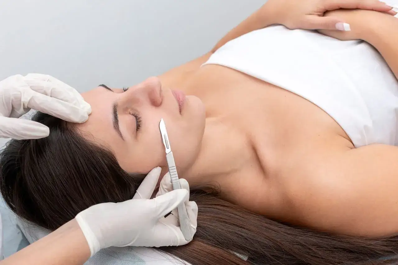 dermaplaning efekty przed po