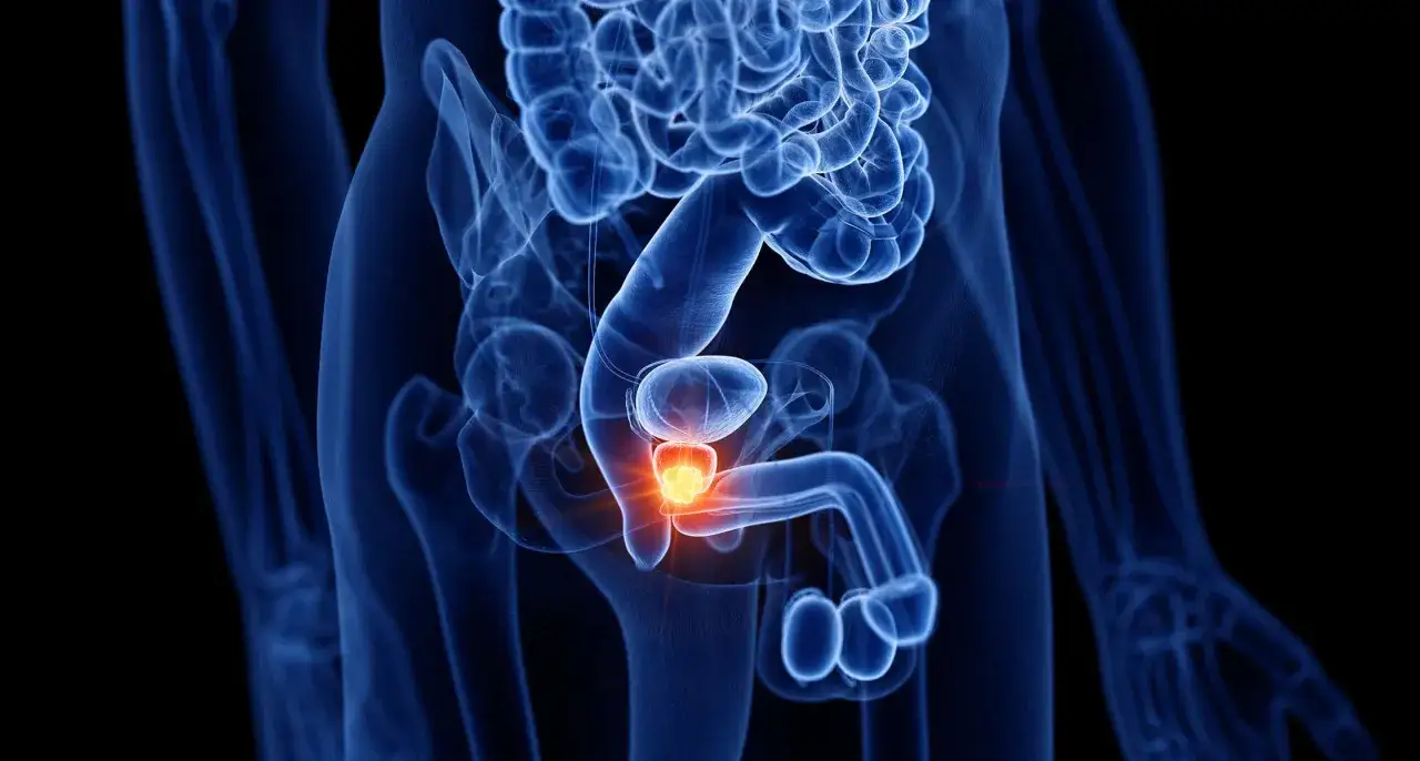M&auml;nnliche Beckenorgane mit leuchtend roter Prostata. M&ouml;gliche Auswirkungen von prostata bestrahlung und alkohol.