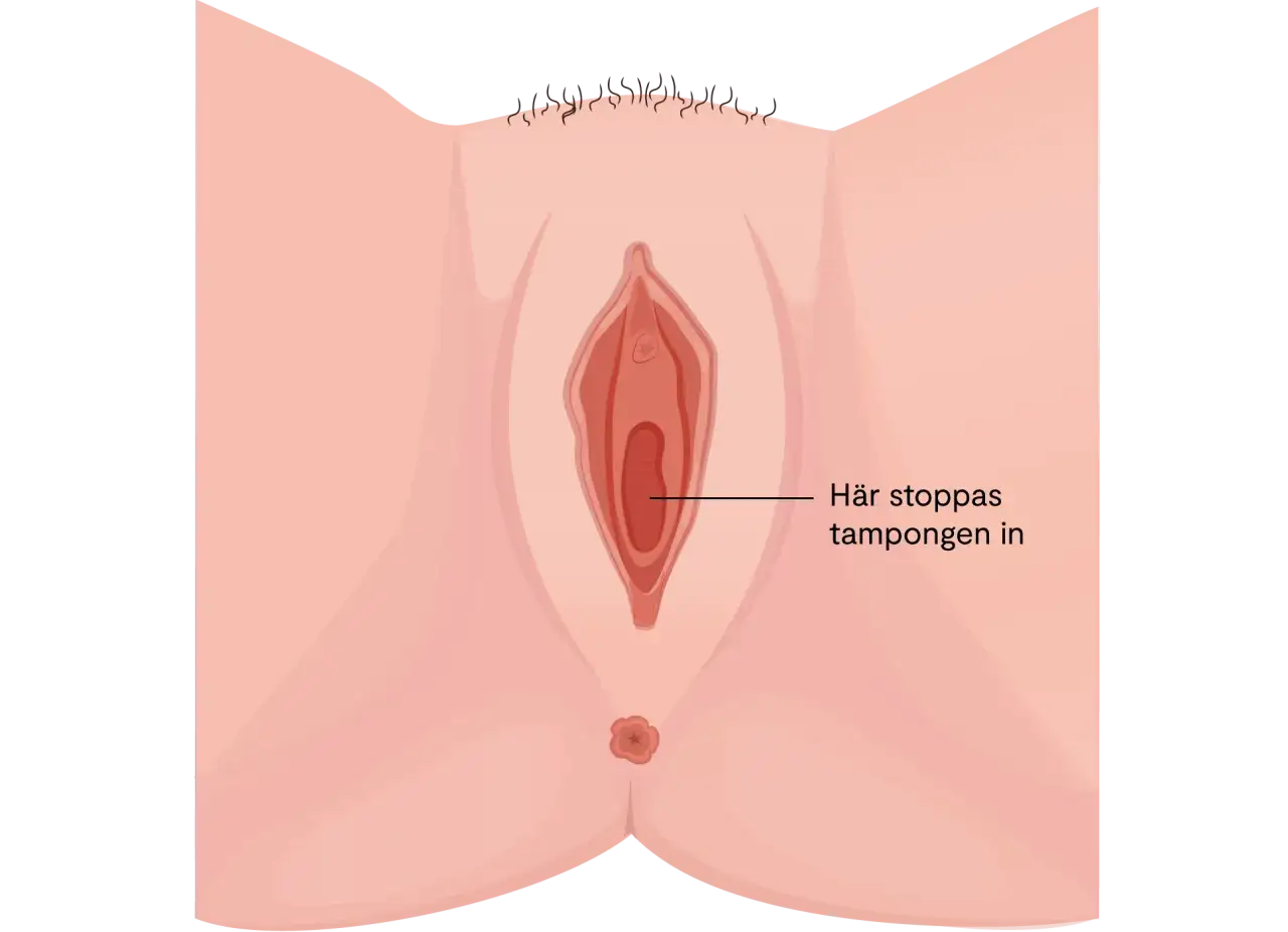 Illustration av en kvinnas underliv. En pil pekar in i vaginan med texten 