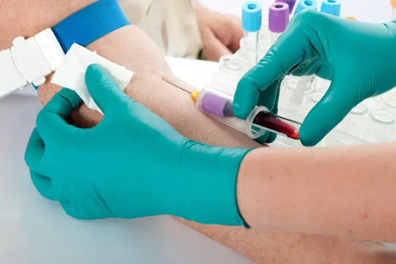 pobieranie krwi do badań laboratoryjnych