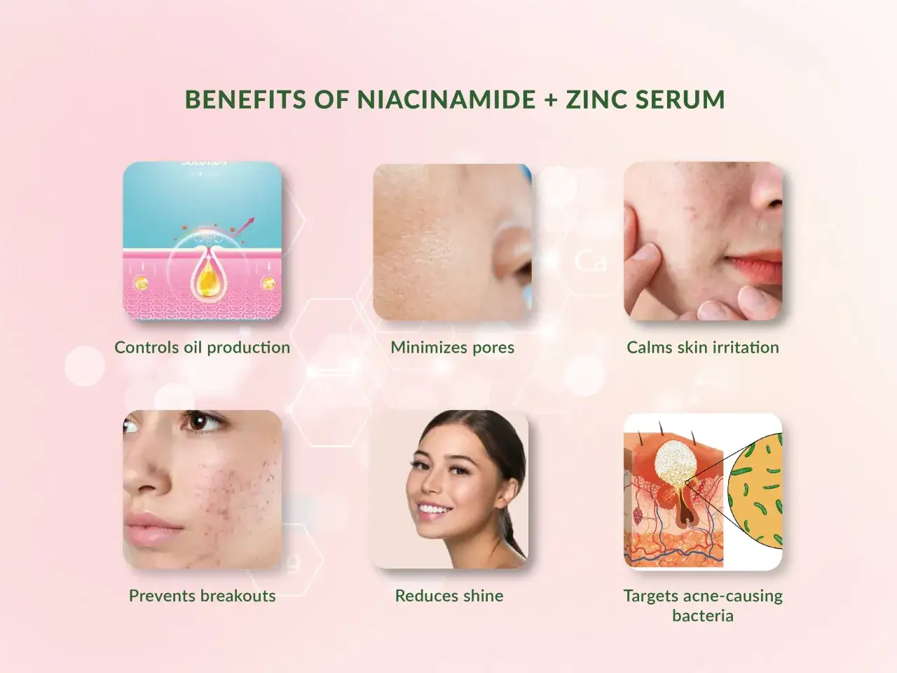 Le niacinamide aide à réguler la production de sébum, minimisant les pores et les imperfections pour une peau grasse éclatante.