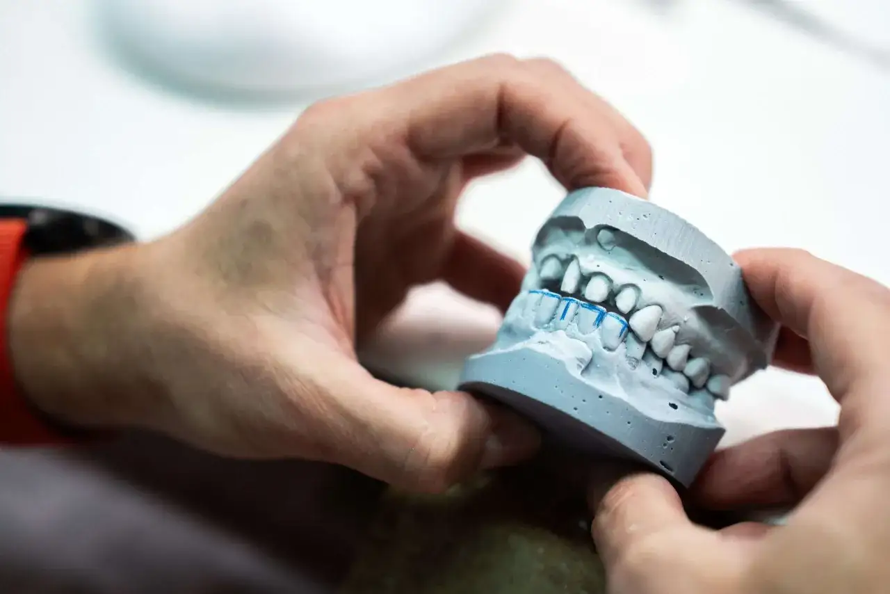 Un odontotecnico cosa fa? Lavora su un modello di denti in gesso, perfezionando la protesi.