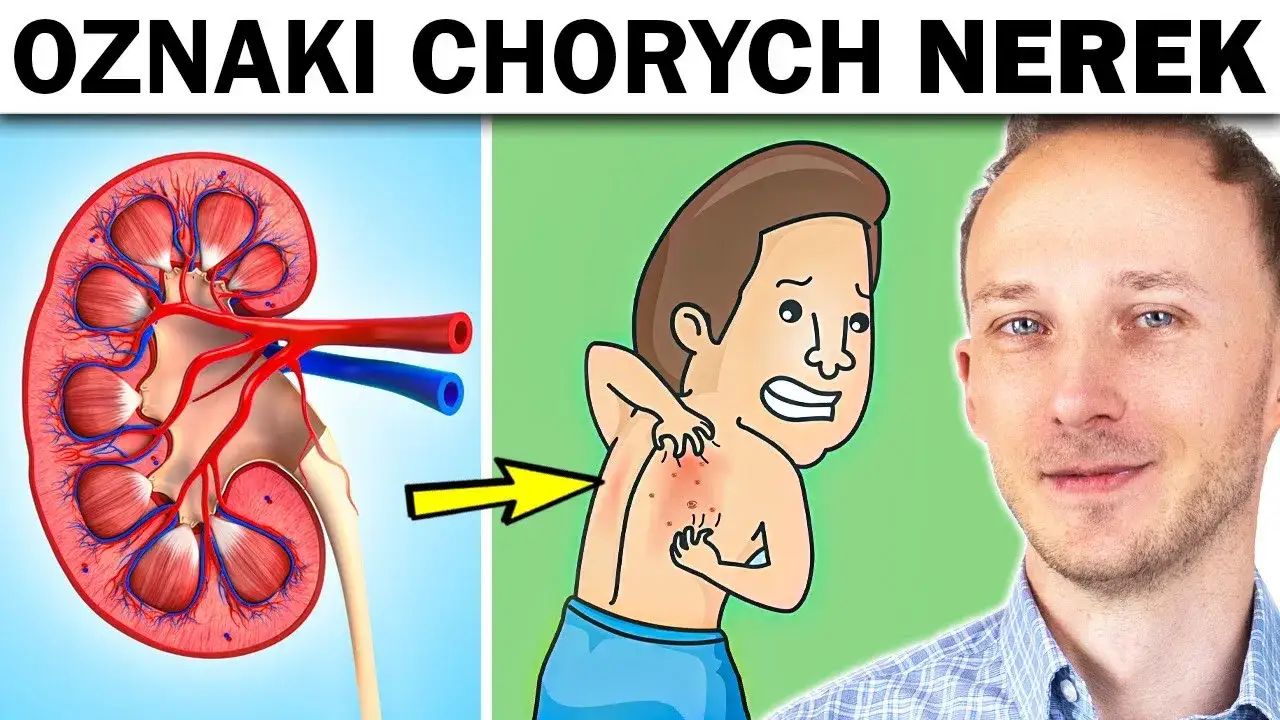 wczesne objawy chor&oacute;b nerek zmęczenie
