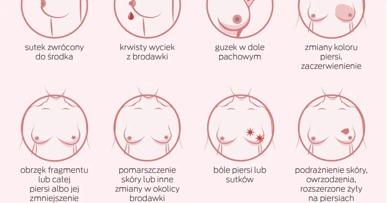 różne objawy raka piersi infografika
