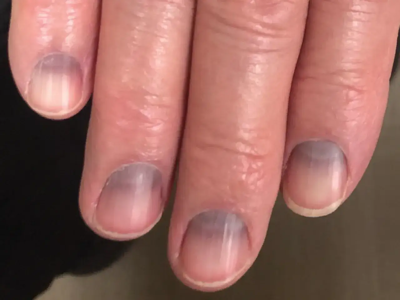 Blaue Fingern&auml;gel K&auml;lte