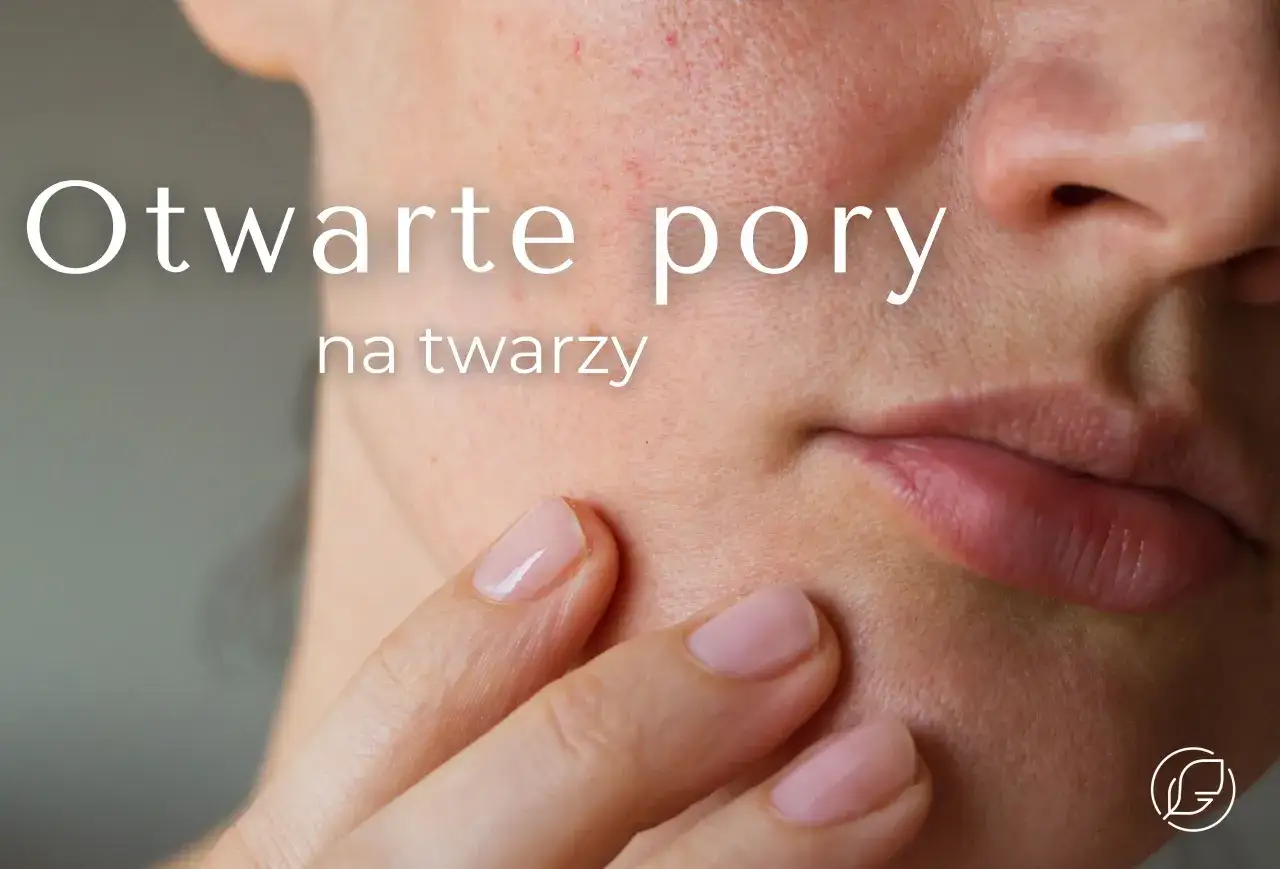 Widoczne otwarte dziurki na twarzy, podkreślone przez delikatny dotyk palca. Skóra z widocznymi niedoskonałościami.