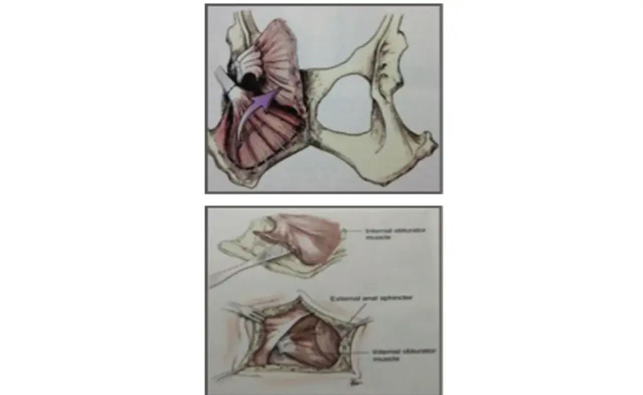 Diagrams illustrating a dog's pelvic anatomy, showing the muscles involved in a perineal hernia repair.
