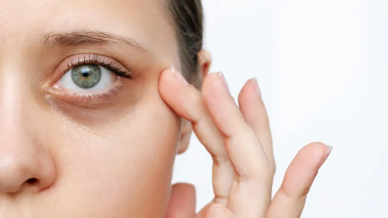Occhiaie scure sotto gli occhi, un problema comune. Sperando che Remescar opinioni negative non si avverino, si applica una crema.