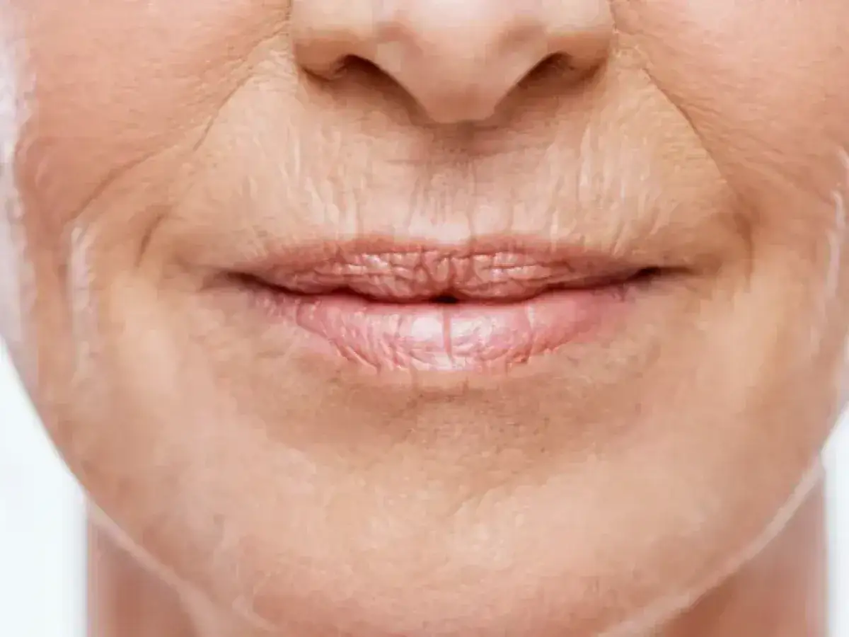 Primer plano de una boca con arrugas en el labio superior, mostrando la textura de la piel madura.