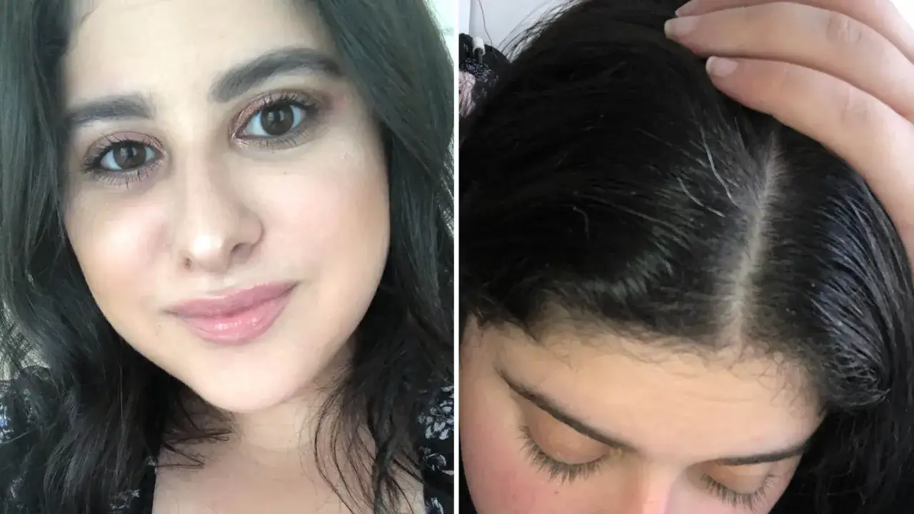 Primer plano de una joven con maquillaje y su cuero cabelludo, mostrando por qu&eacute; me salen canas si soy joven.