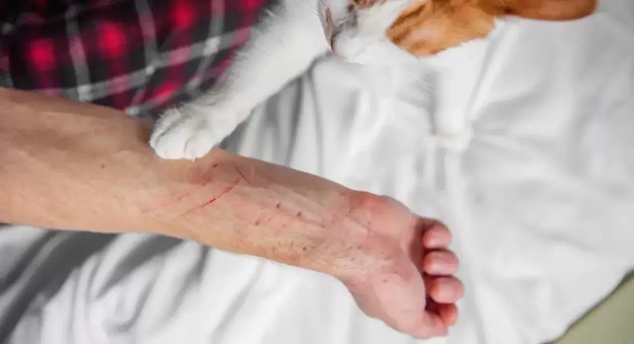 Gato blanco y naranja jugando, dejando rasgu&ntilde;os en un brazo. Ejemplos de tipos de heridas en gatos.