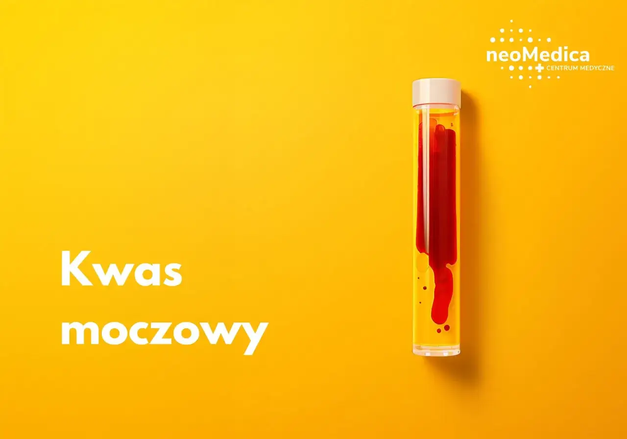 Kwas moczowy: badanie z krwi czy z moczu? Probówka z czerwonym płynem i logo neoMedica.