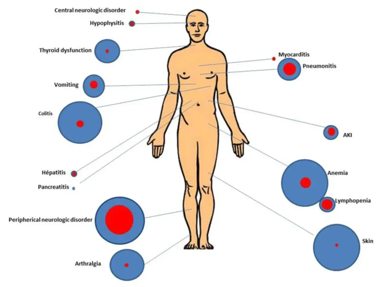 Schemat ukazuje możliwe immunoterapia skutki uboczne: zaburzenia neurologiczne, hormonalne, zapalenia, problemy z krwią, sk&oacute;rą i inne.