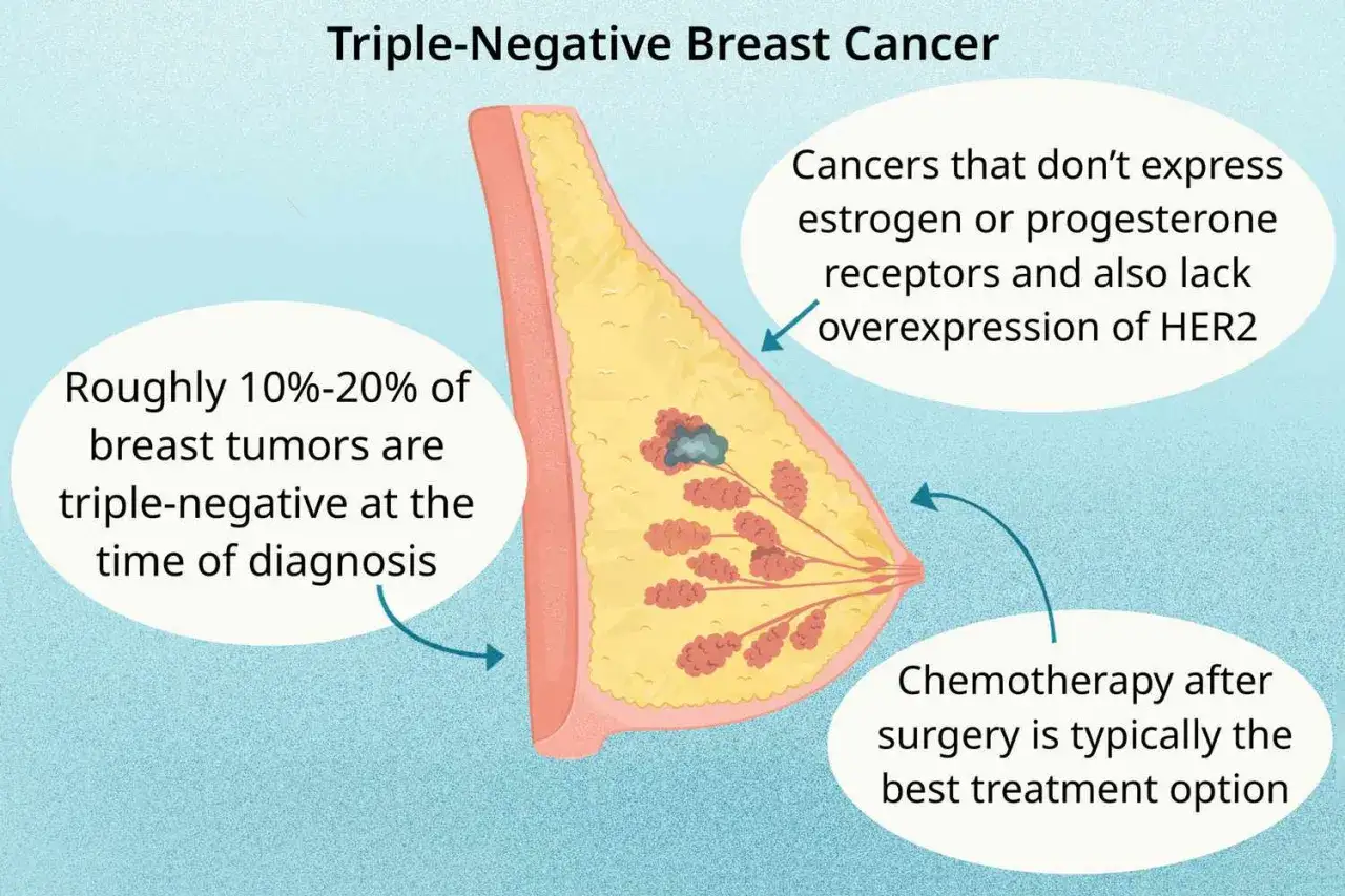Brustkrebs: 10-20% sind triple-negativ, was oft einem Todesurteil gleichkommt. Chemotherapie ist die beste Option.