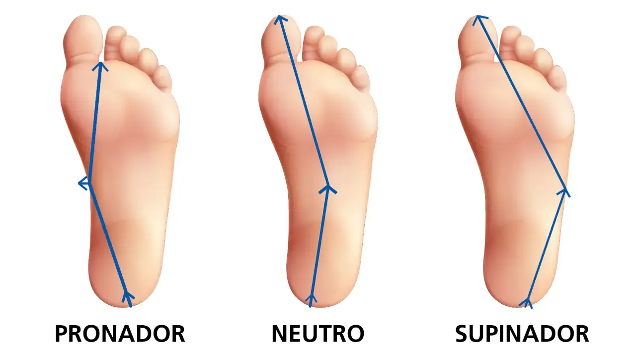 Tres tipos de pisada: pronador, neutro y supinador. La pisada pronadora muestra un desvío hacia adentro del pie.