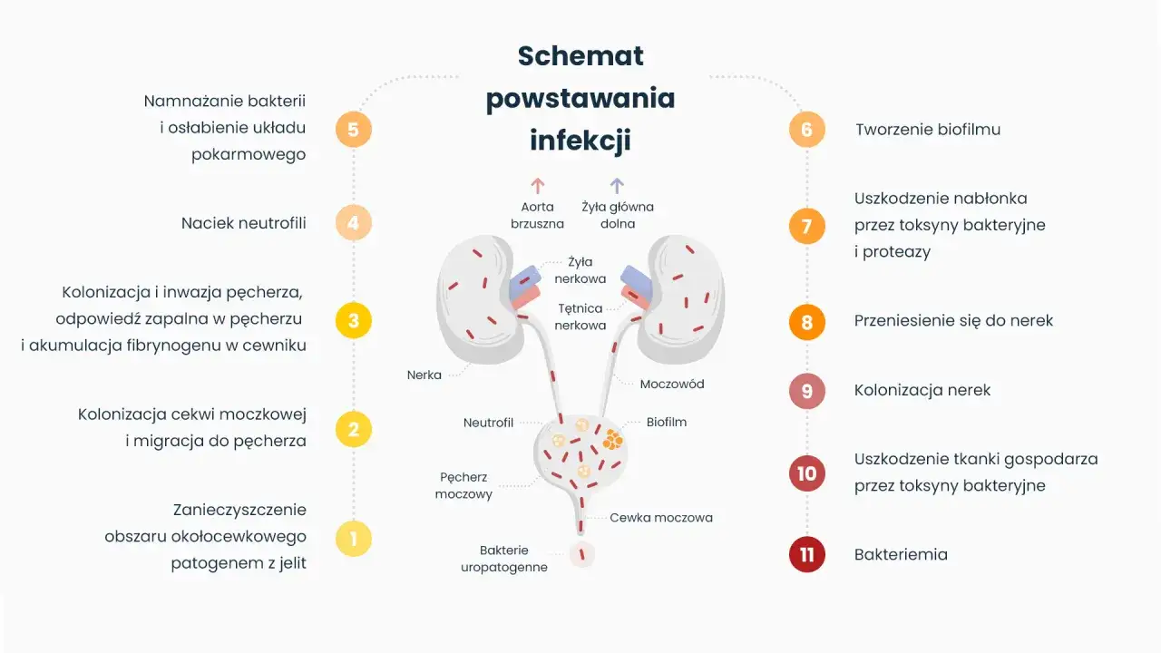 Schemat infekcji dróg moczowych, od zanieczyszczenia jelitowego po zapalenie cewki moczowej, kolonizację pęcherza i nerek, aż do bakteriemii.