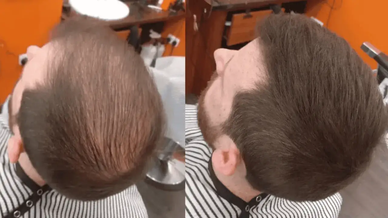 Avant/après : cheveux clairsemés et secs, puis une chevelure dense et soignée.