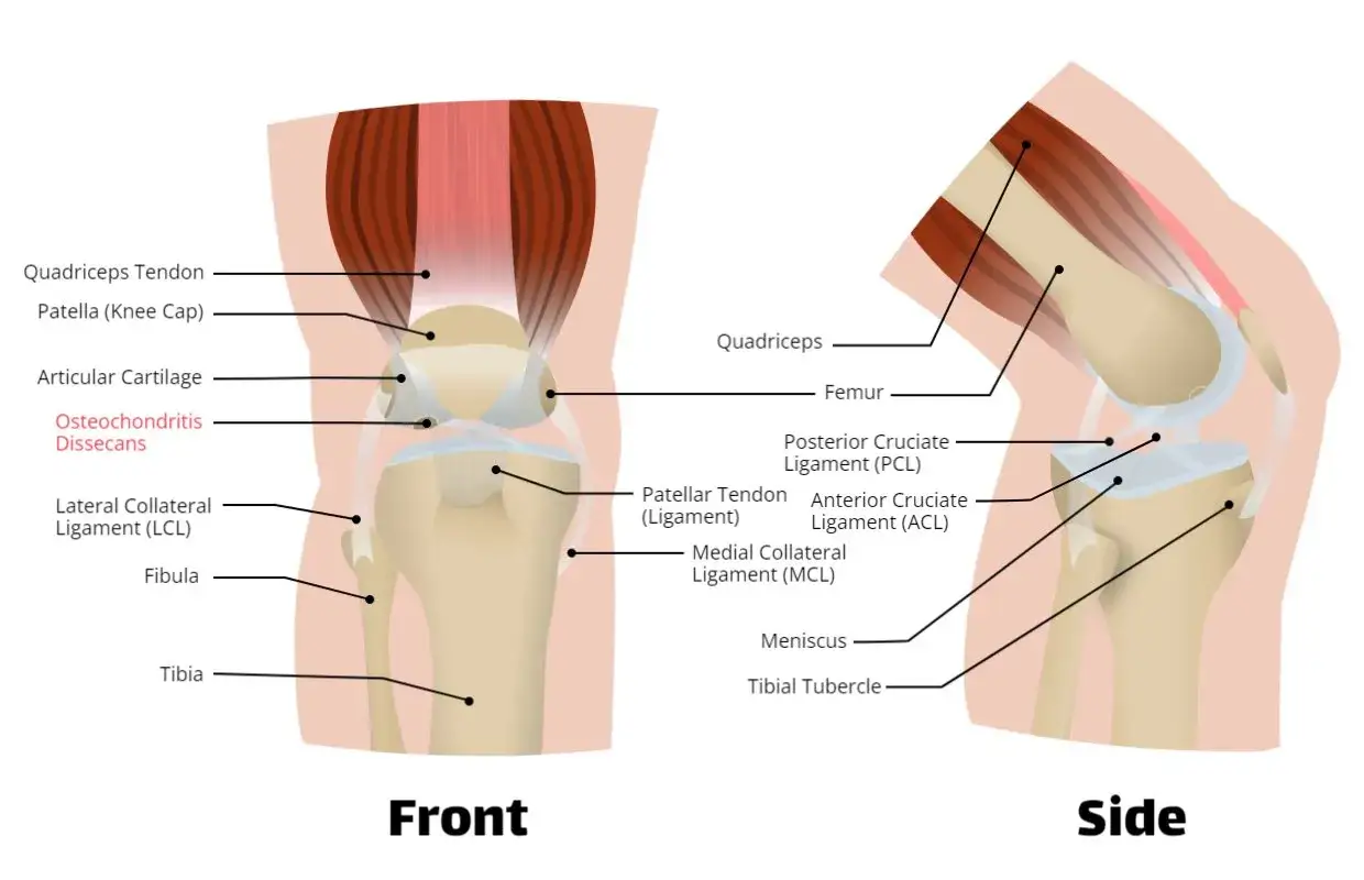 Anatomía de la rodilla, mostrando ligamentos, tendones y cartílago. La osteocondritis disecante puede causar dolor rodilla crecimiento.