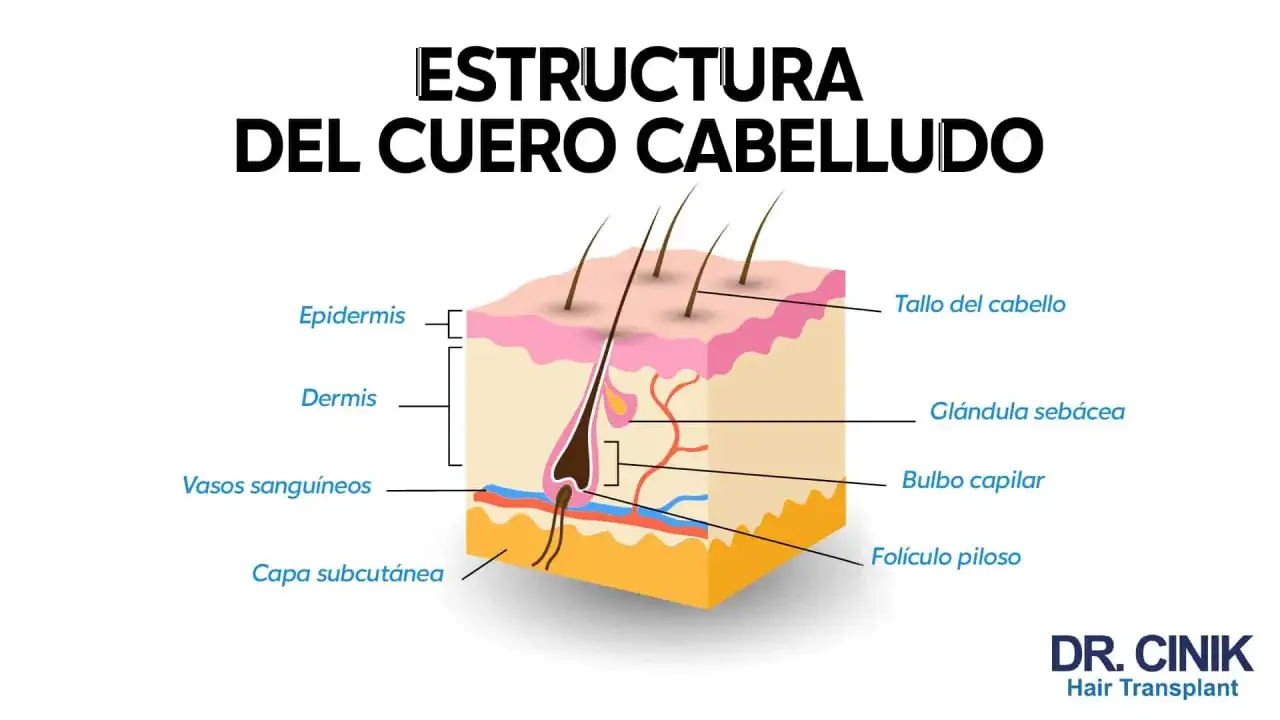 Corte transversal del cuero cabelludo mostrando la estructura del pelo, folículo piloso, bulbo capilar y glándula sebácea.