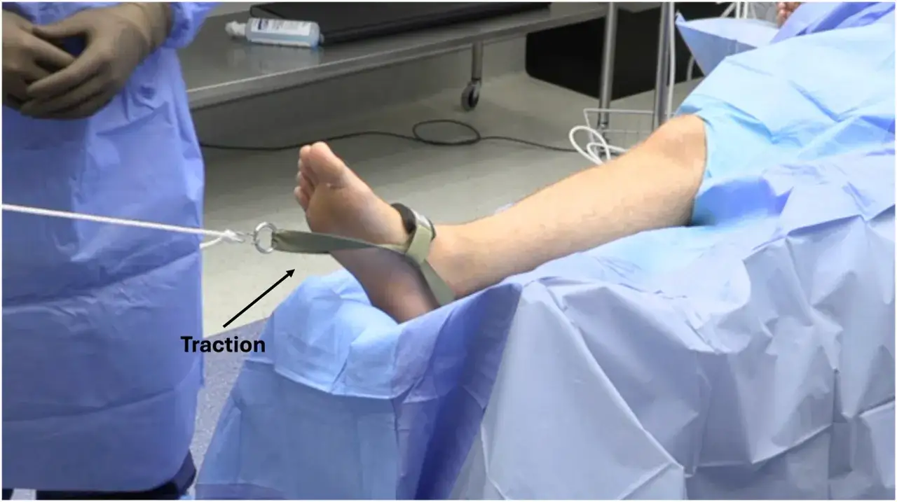 Medizinische Traktion am Fuß zur Knie-Distraktion. Ein Seil zieht am Fuß, um das Knie zu entlasten.