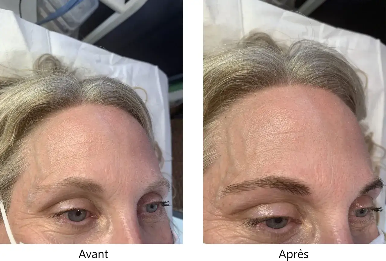 Avant/apr&egrave;s teinture sourcils : des sourcils plus d&eacute;finis et fonc&eacute;s pour un regard plus intense.