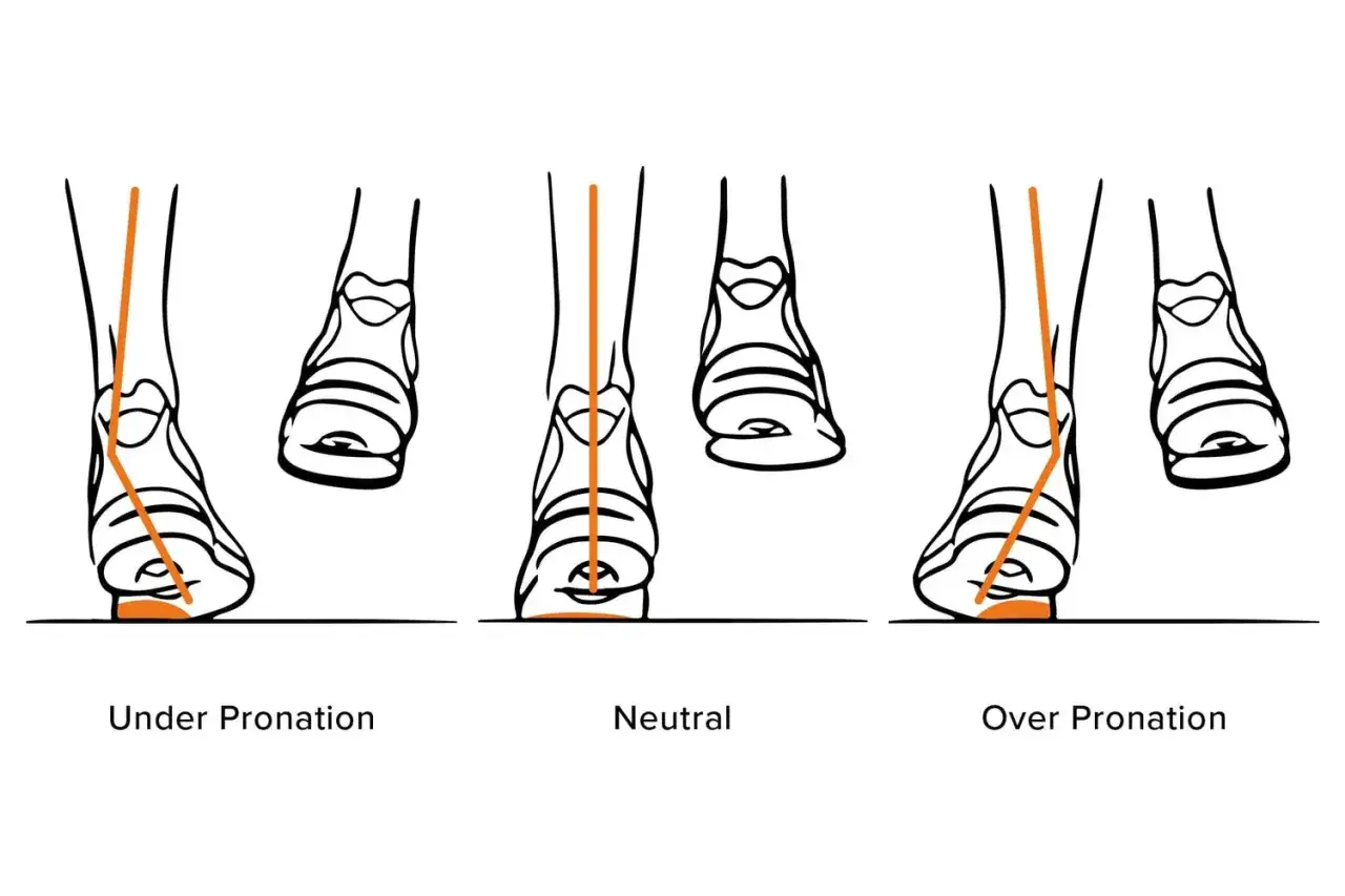 Illustration zeigt drei Fußstellungen beim Laufen: Unterpronation, neutrale Fußstellung und Überpronation.