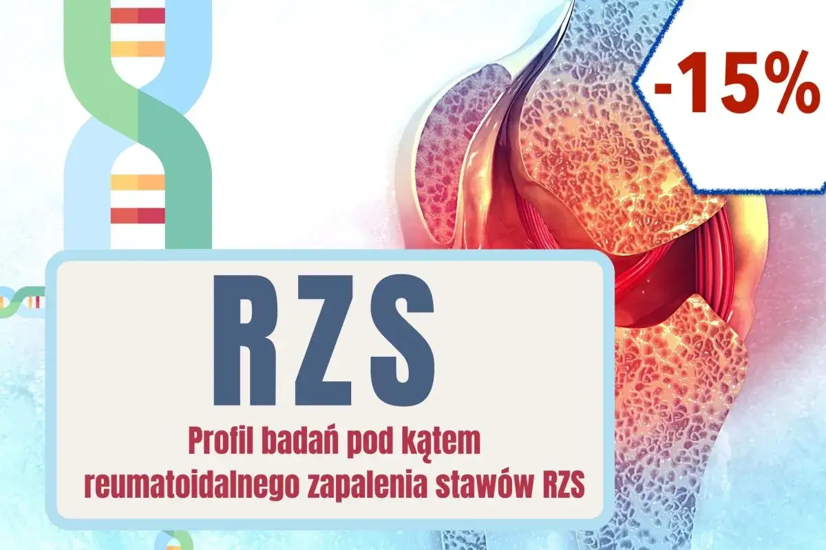Profil badań pod kątem reumatoidalnego zapalenia stawów RZS. Badanie czynnika reumatoidalnego. -15%.