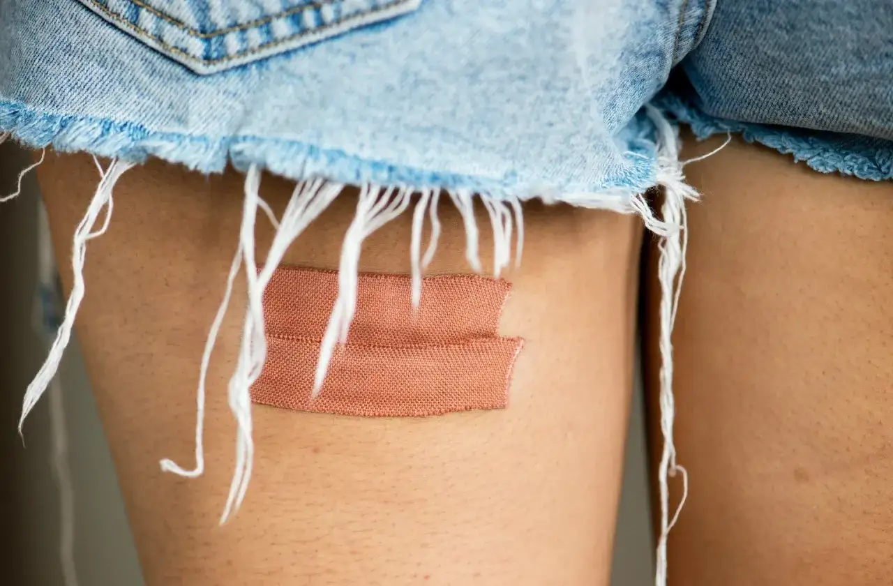 Cerotto su una coscia, sotto un bordo sfilacciato di jeans. Chissà, forse una cicatrice sole dopo quanto tempo si vedrà.