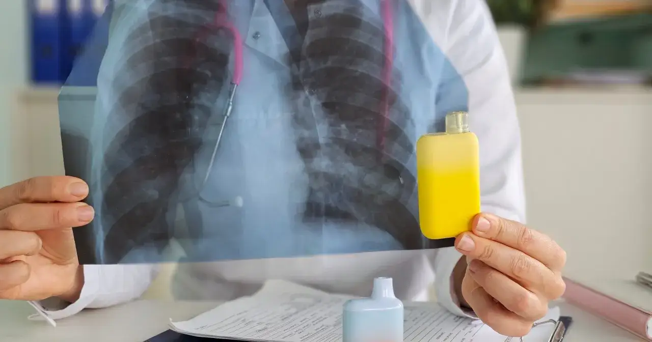 Lekarz pokazuje zdjęcie RTG płuc i dwa e-papierosy, ilustrując skutki palenia e papieros&oacute;w.
