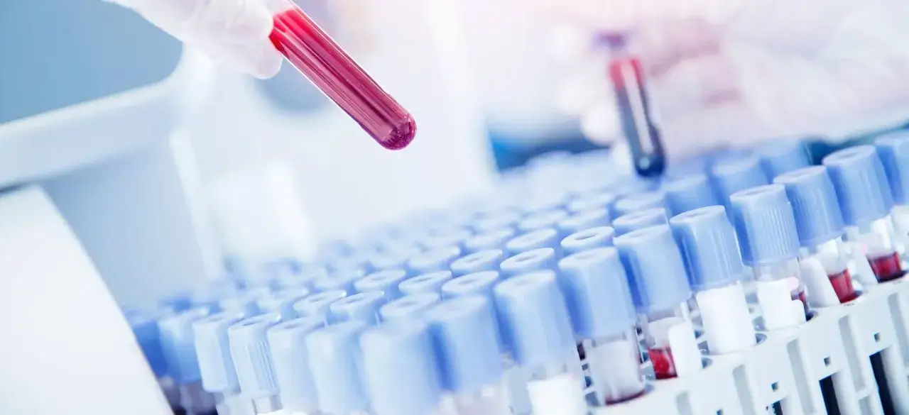 Rękawiczka laboratoryjna trzyma probówkę z krwią. W tle rząd probówek w stojaku, typowy dla punktu pobrań materiałów do badań.