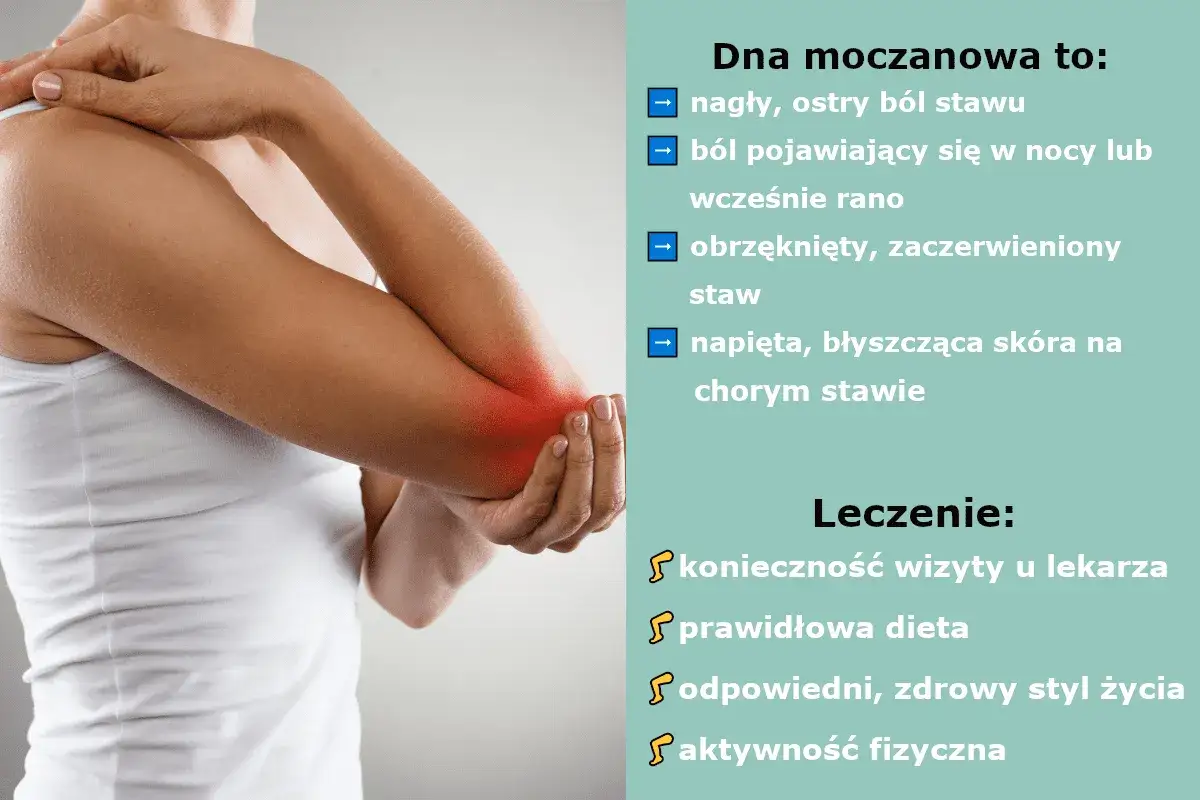 Ból łokcia z zaczerwienieniem i obrzękiem, objawy dny moczanowej. Hiperurykemia może prowadzić do takich ataków. Leczenie obejmuje wizytę u lekarza, dietę i aktywność fizyczną.