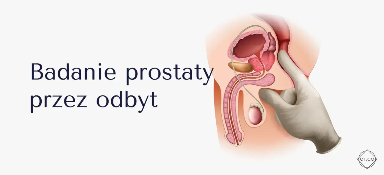 Ilustracja przedstawia badanie per rectum, które pozwala ocenić funkcję prostaty.
