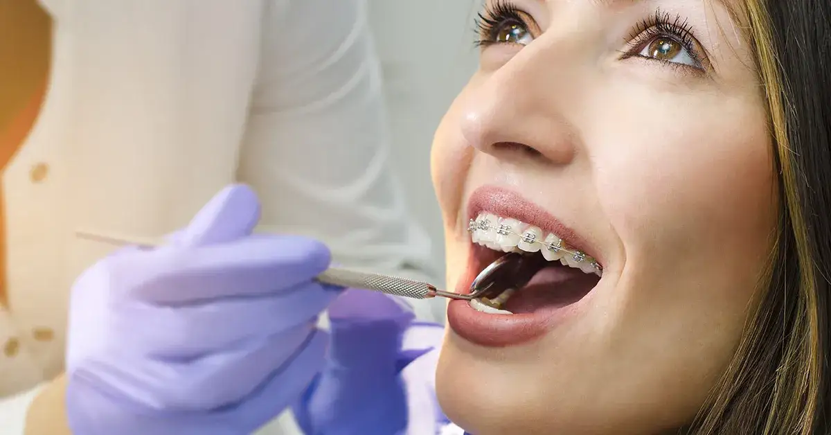Zdjęcie Czym się różni dentysta od ortodonty i kiedy ich potrzebujesz?