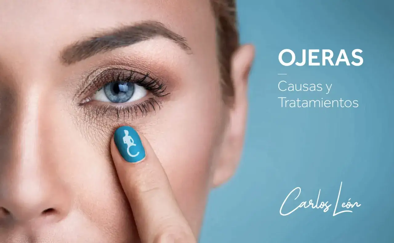 Primer plano de un ojo con ojeras, indicando las causas y tratamientos. El dedo &iacute;ndice con un s&iacute;mbolo azul resalta la zona.