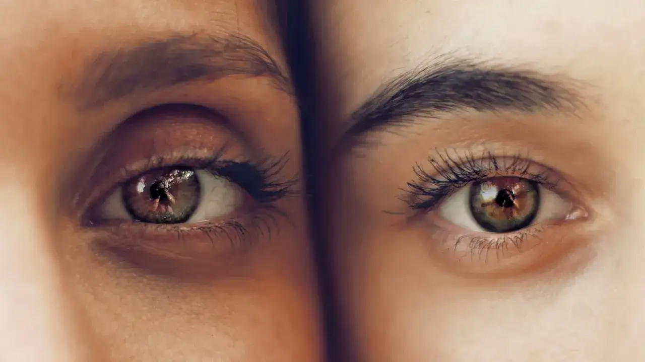 Primer plano de dos ojos, uno con ojeras marcadas y otro m&aacute;s luminoso. Consejos para como reducir ojeras.
