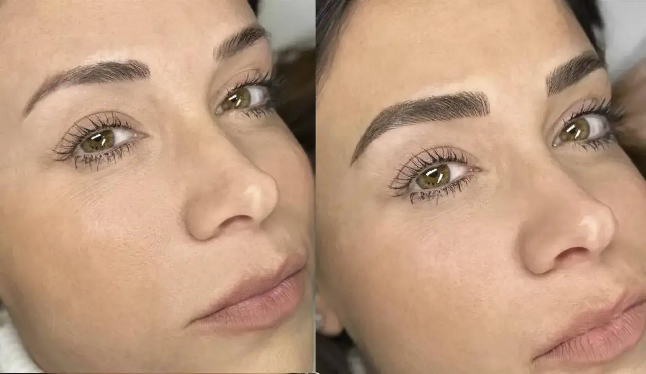 Comparativa de microblading cejas: antes y despu&eacute;s. Un rostro con cejas m&aacute;s definidas y naturales tras el tratamiento.