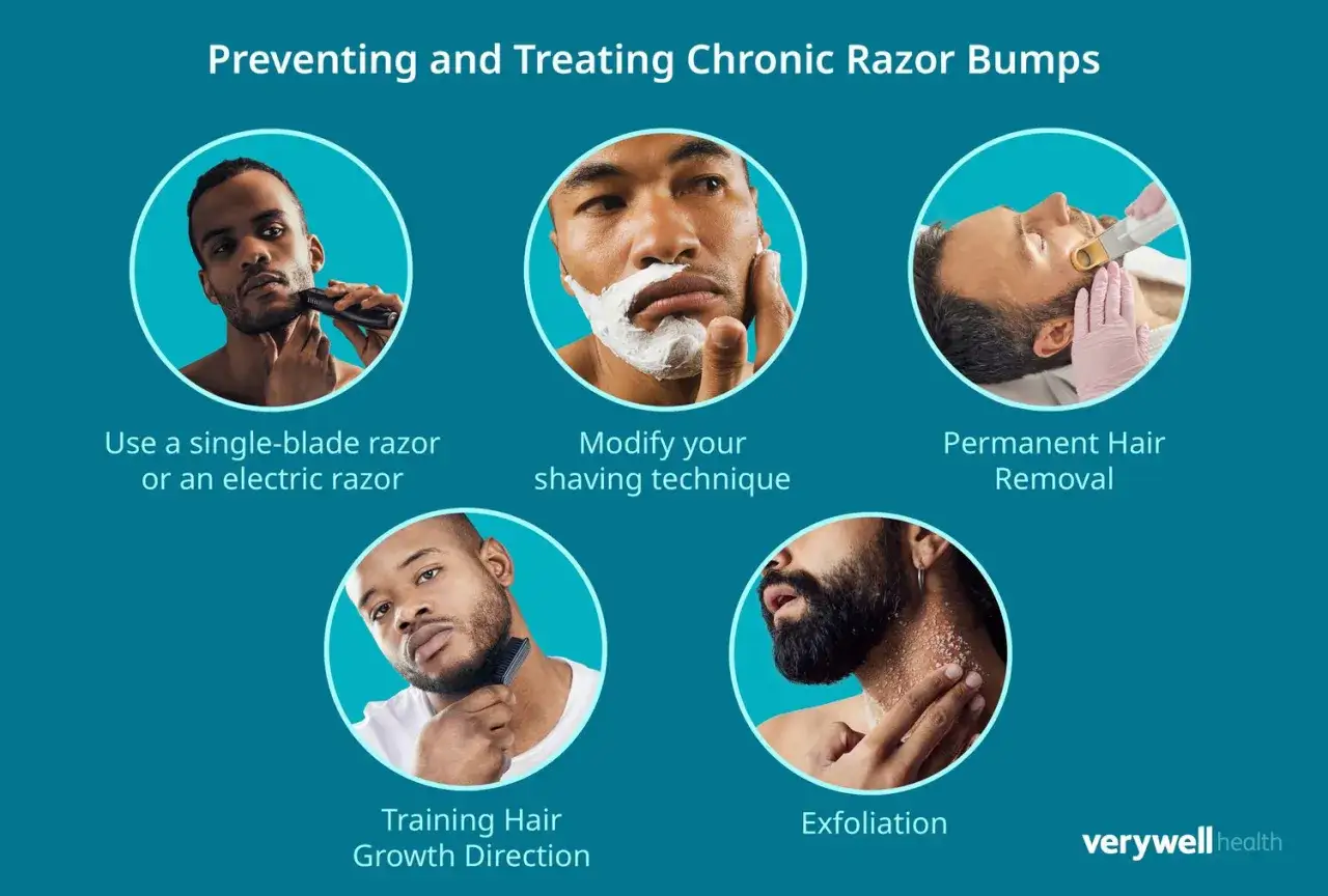 Hombres con piel irritada por afeitado. Se muestran m&eacute;todos para prevenir y tratar los bultos de afeitado: rasuradoras, t&eacute;cnica, depilaci&oacute;n, direcci&oacute;n del crecimiento y exfoliaci&oacute;n.