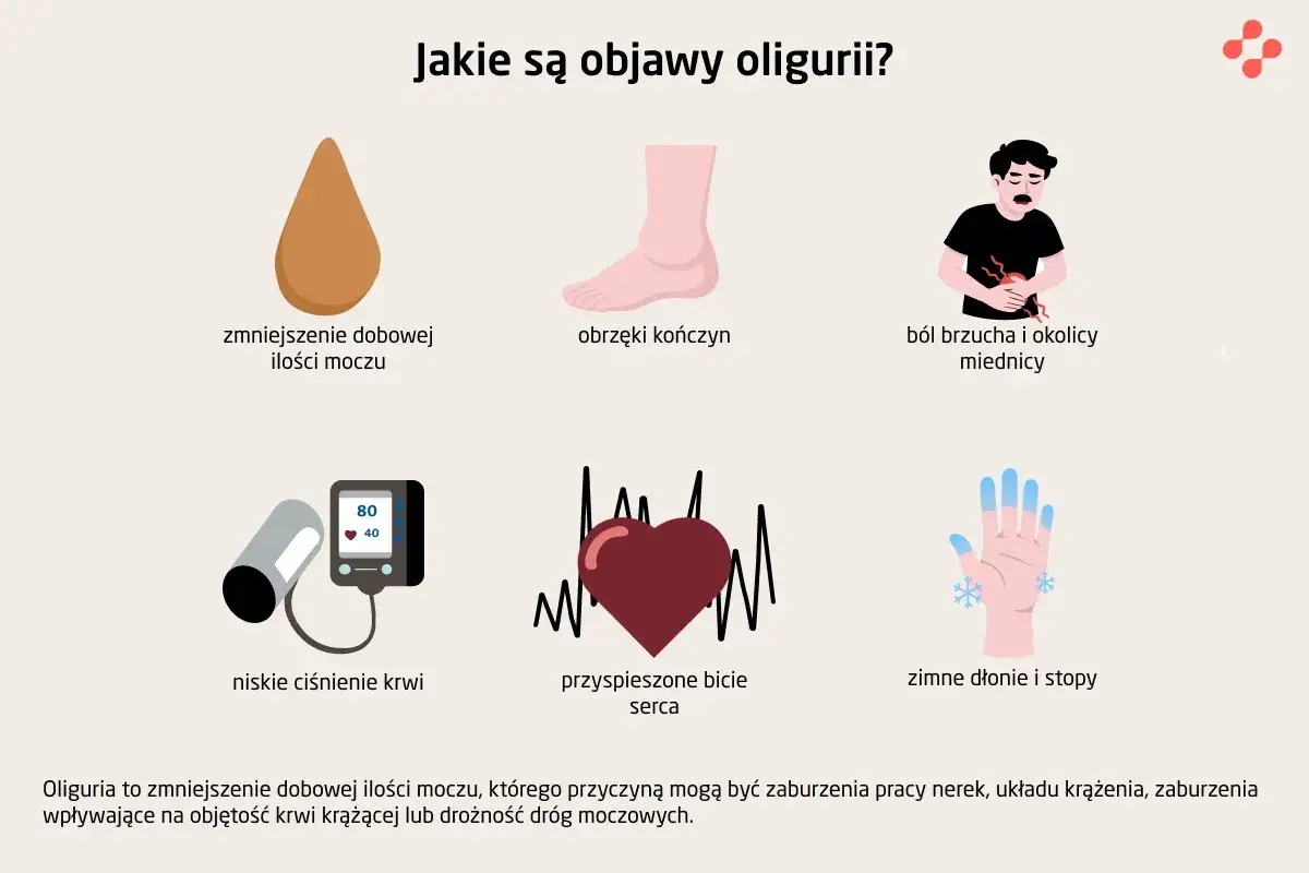Objawy oligurii: zmniejszone oddawanie moczu, obrzęki, ból brzucha, niskie ciśnienie, przyspieszone bicie serca, zimne dłonie i stopy.