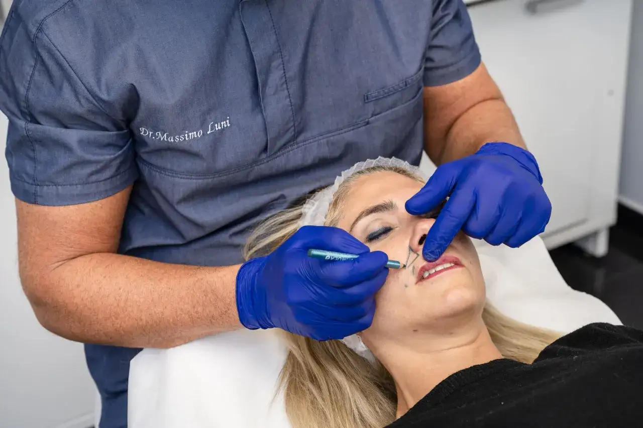 Medico con guanti blu disegna sul viso di una donna per togliere le rughe.