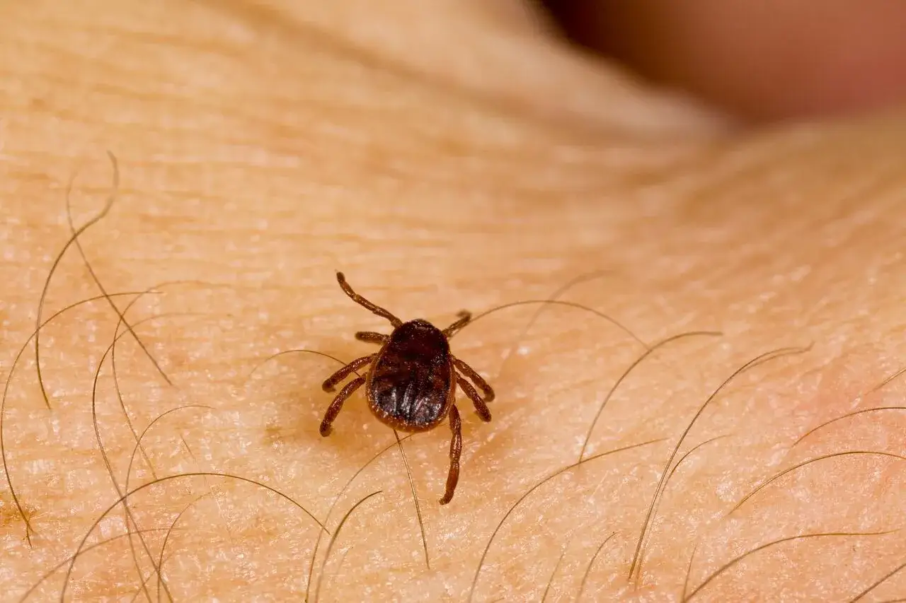 Una garrapata se arrastra sobre piel humana, un detalle que podría hacerte soñar con garrapatas.