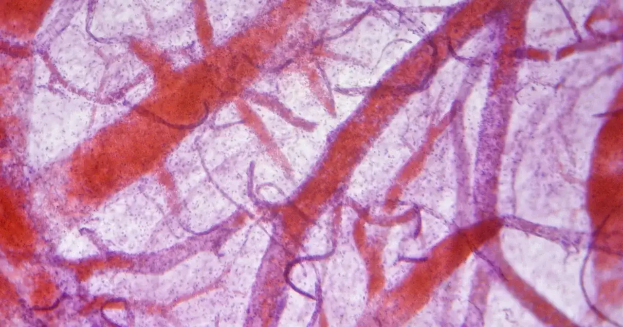 Mikroskopowy obraz naczyń krwionośnych, przypominający siatkę. To właśnie pokazuje angiografia co to jest – badanie obrazujące naczynia.
