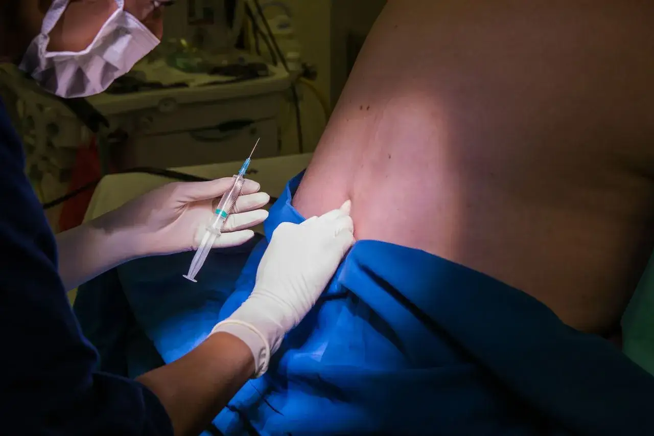 Znieczulenie podpajęczyn&oacute;wkowe procedura medyczna