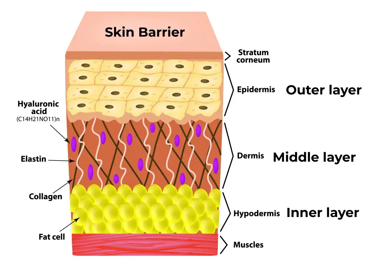 Coupe de la peau montrant les couches : &eacute;piderme, derme, hypoderme. Une barri&egrave;re cutan&eacute;e saine est essentielle pour &eacute;viter la peau s&egrave;che cause.