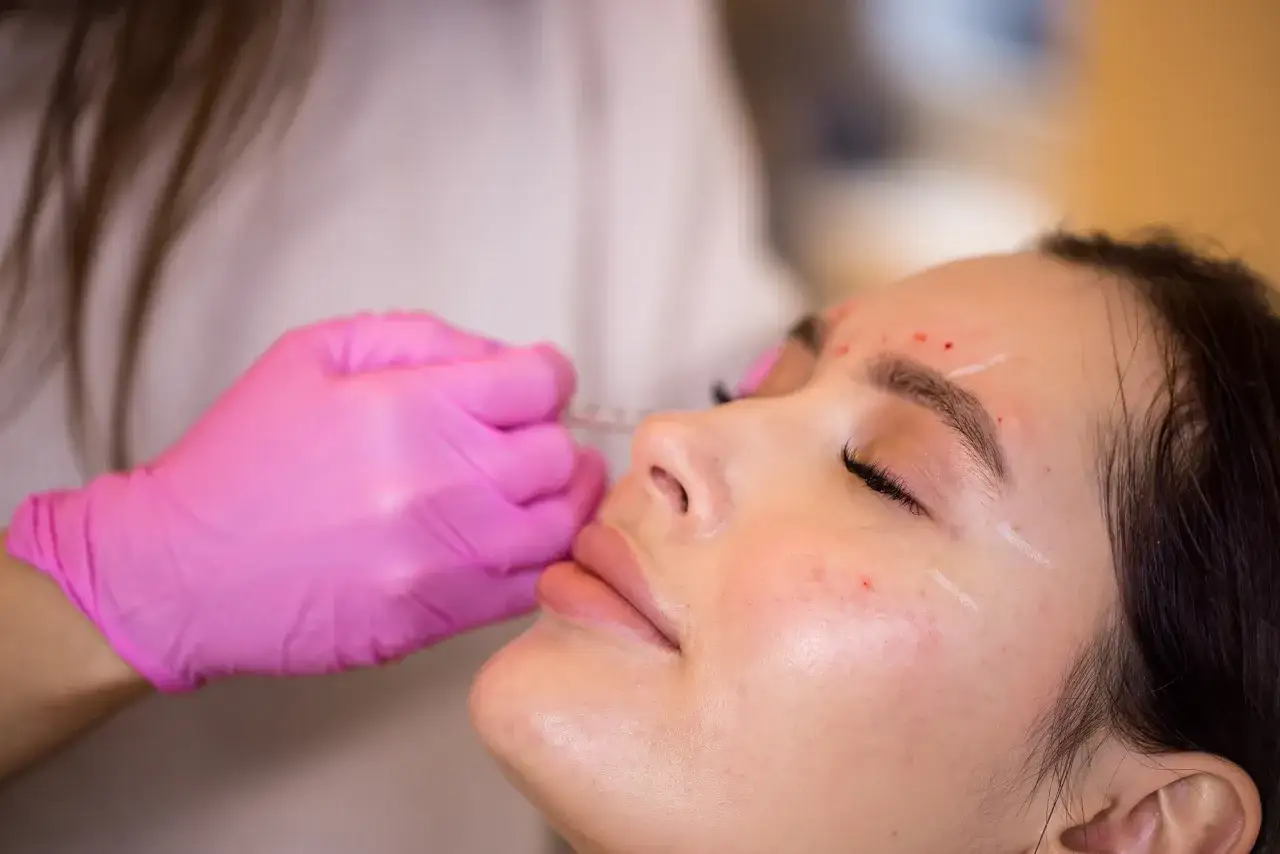 Una mano enguantada en rosa administra un tratamiento facial con exosomas, marcando puntos en la piel para una aplicaci&oacute;n precisa.