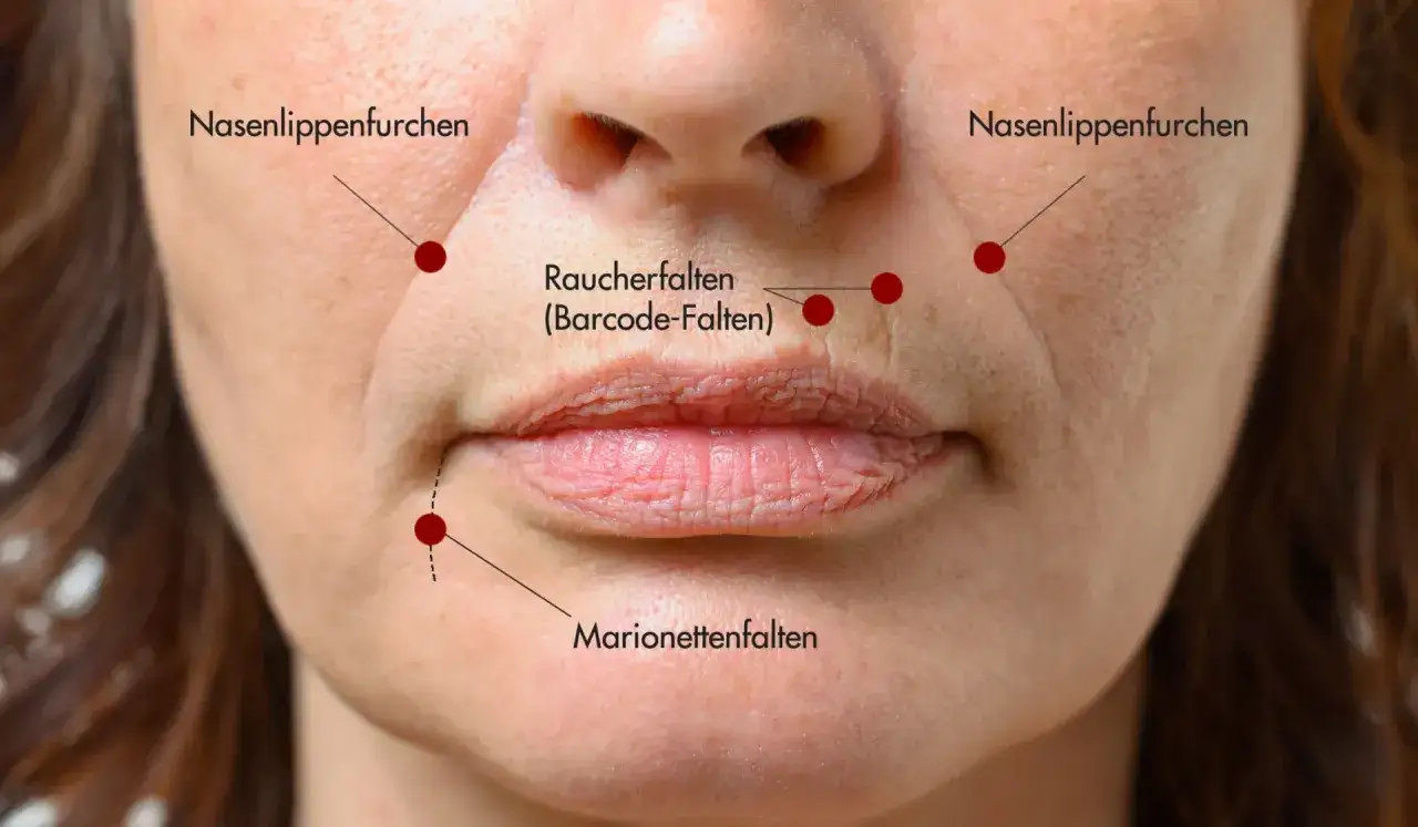 Nahaufnahme eines Mundes mit sichtbaren Nasolabialfalten, Raucherfalten und Marionettenfalten, die auf nat&uuml;rliche Weise durch das Leben und Lachen entstanden sind.