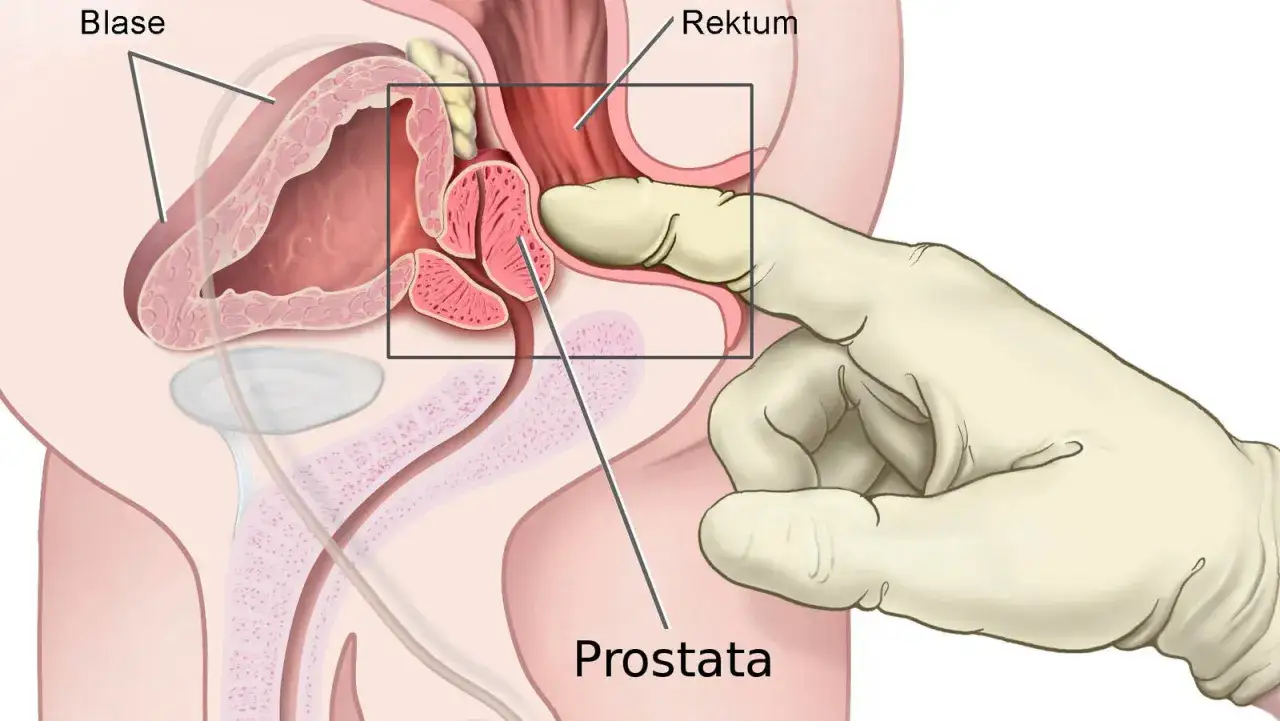 Digitale Darstellung der Prostata, die f&uuml;r die Bestimmung des PSA-Wertes untersucht wird.
