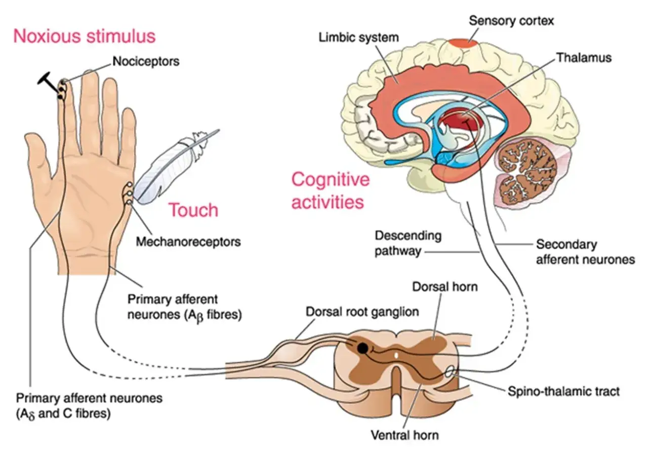 Diagramma del percorso del dolore: stimoli nocivi e tattili dalla mano al cervello, illustrando la disestesia neurologica.