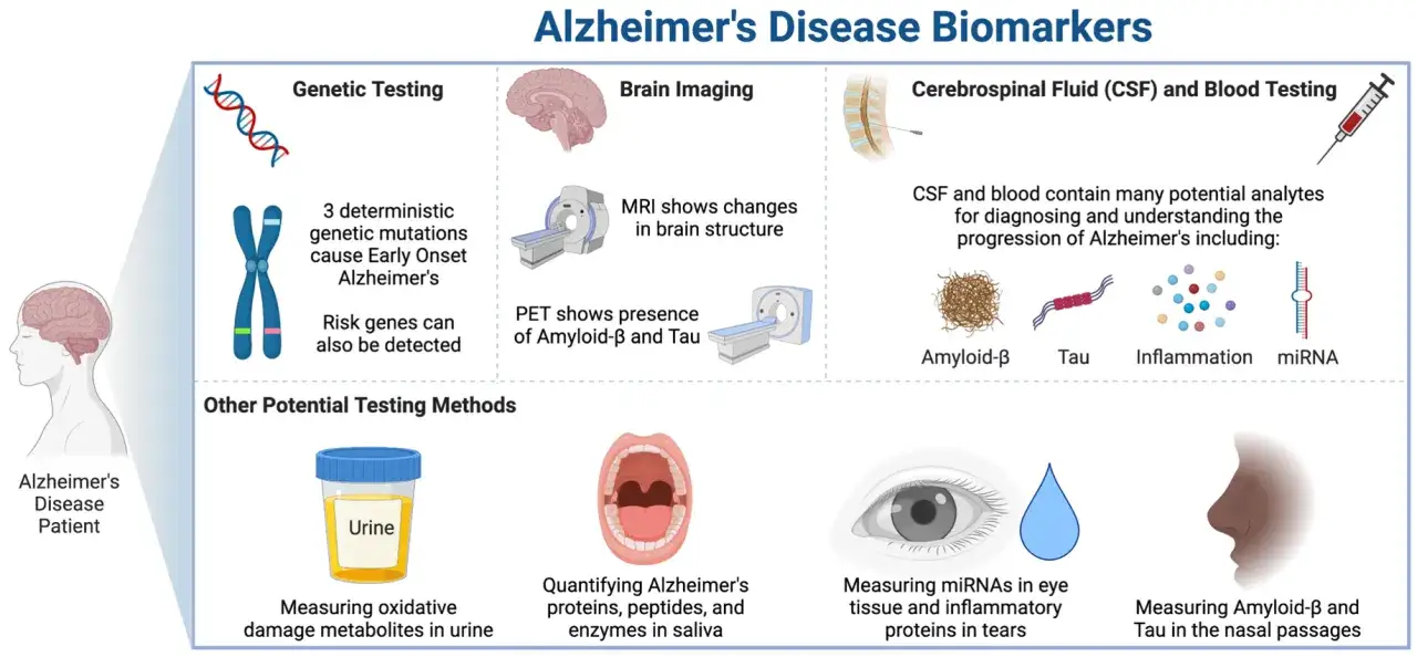 Esami per Alzheimer: test genetici, imaging cerebrale, analisi di CSF e sangue (per amiloide-beta, tau, infiammazione, miRNA), urine, saliva, lacrime e passaggi nasali.