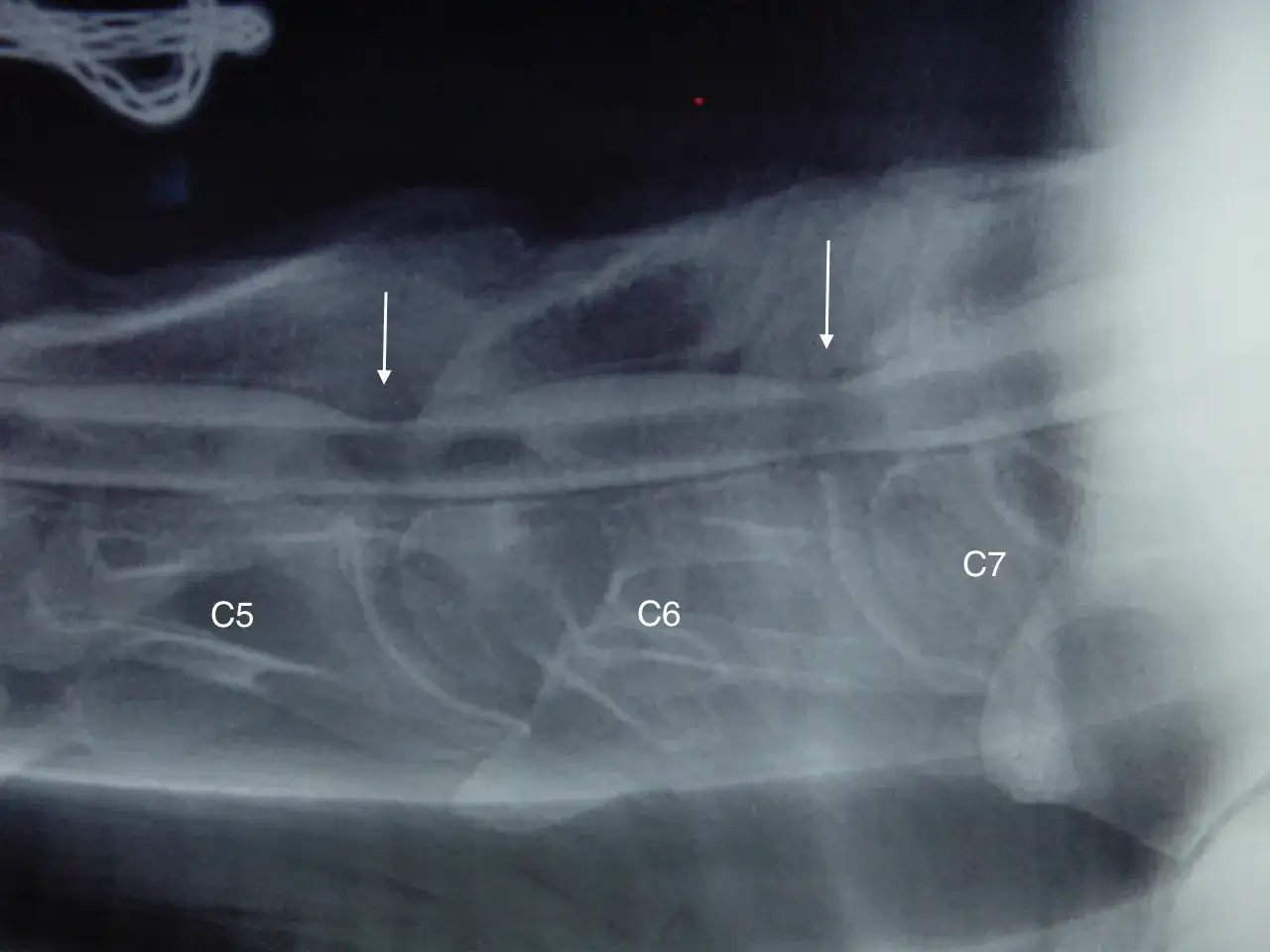 Radiographie montrant l'arthrose cervicale d'un cheval, avec des signes d'usure sur les vertèbres C5, C6 et C7, indiqués par des flèches.